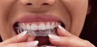 Everything You Need To Know