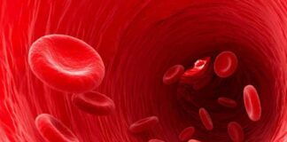 Desmopressin vs Moderate-intensity Exercise in Mild Hemophilia A Adolescent Males