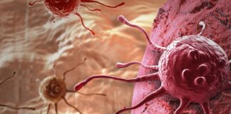 High-intensity aerobic exercise can cut metastatic cancer risk by 72%