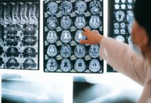 A Death During an Alzheimer’s Drug Trial Ignites Safety Concerns