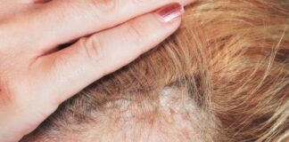 Know Their Symptoms, Treatments, And Prevention