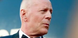 Frontotemporal Dementia Usually Affects People Under 60 — What Causes It?