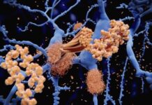 These Lesser-Known Toxic Proteins Are Found in 60% of Alzheimer’s Cases