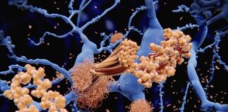 These Lesser-Known Toxic Proteins Are Found in 60% of Alzheimer’s Cases