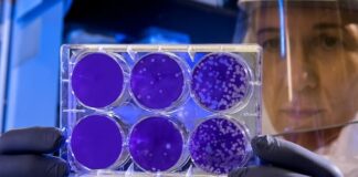 Marauders of the Microbiome: Certain Gut Bacteria Found Thriving in People With Alzheimer’s, APOE4