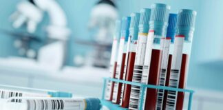 Rise Of At-Home Lab Tests