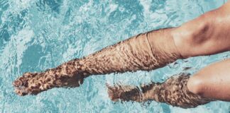 Too Much Sun? Here’s How to Soothe Your Skin