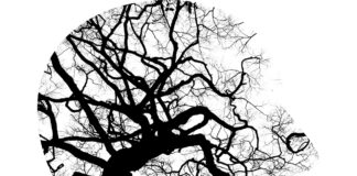 Alzheimer’s vs. Vascular Dementia: What’s the Difference?