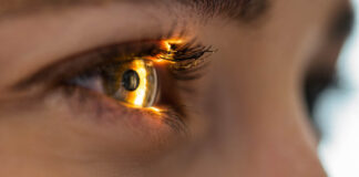 The Controversy Surrounding Lasik Eye Surgery