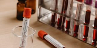 The Real Story on Alzheimer’s Blood Tests