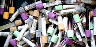 5 Things You Need to Know About Blood Tests for Alzheimer’s